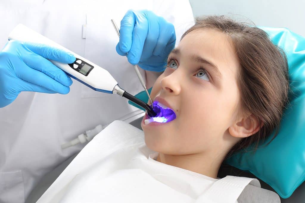 Are Dental Sealants Worth It? Understanding Lifespan and Long-Term Value