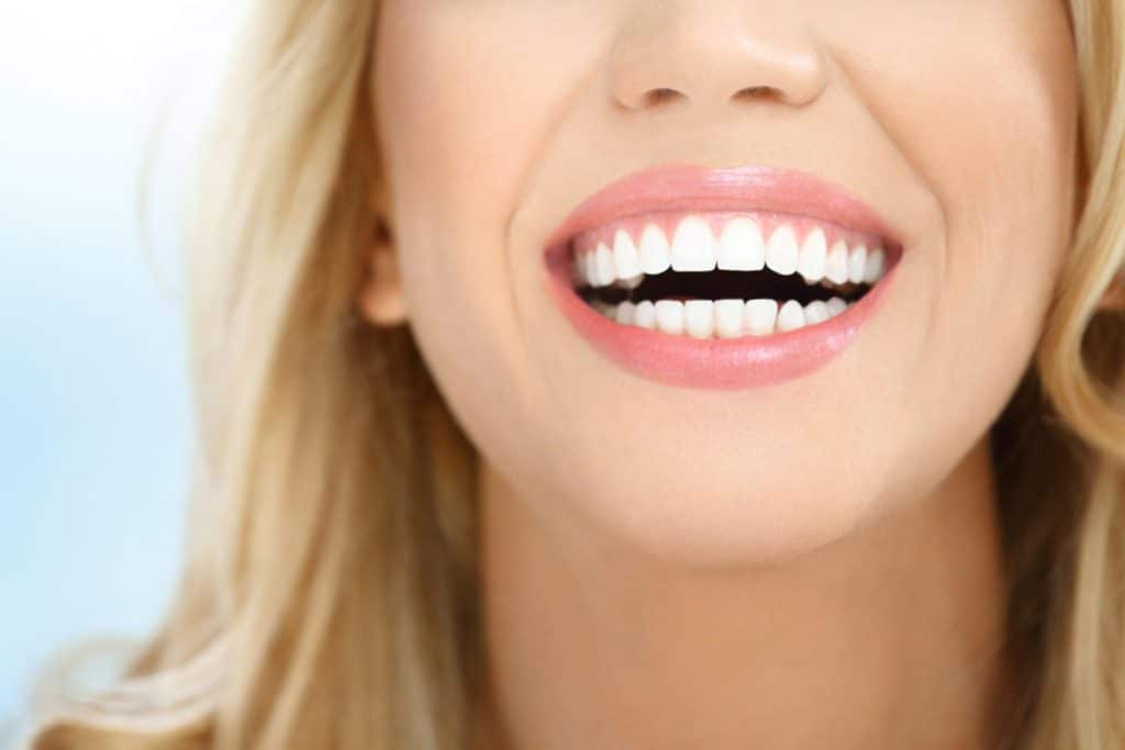 Ultimate Guide to Maintaining Your Teeth Whitening Results